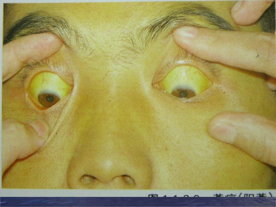 50岁男子肚子疼可能是癌症吗,男子肚子疼就检查出癌症