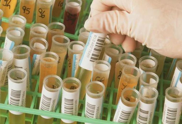 夜里起夜频繁是否肾有问题,经常起夜会不会肾衰竭