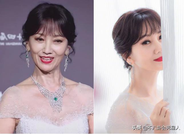 颈纹越来越多越来越显老怎么办,顽固又显老的颈纹