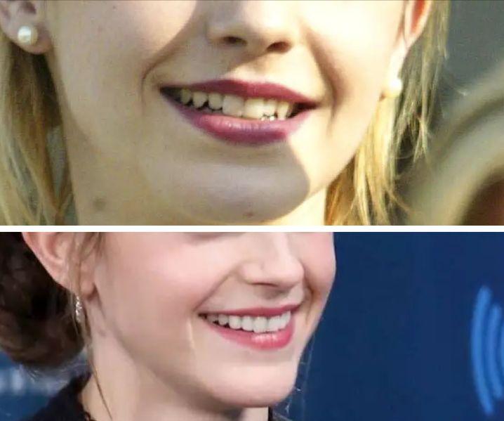 艾玛沃特森10岁到28岁颜值变化,艾玛沃特森为什么那么瘦