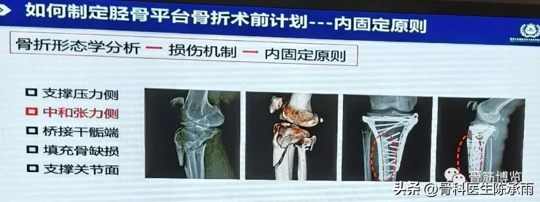 国家卫健委主办的骨创伤专项能力培训项目----下肢损伤学习班