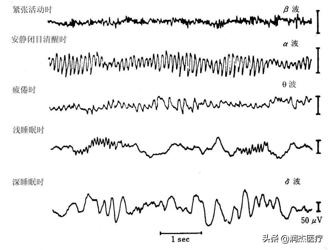 神经衰弱失眠电疗,神经衰弱失眠可以用助眠器具吗
