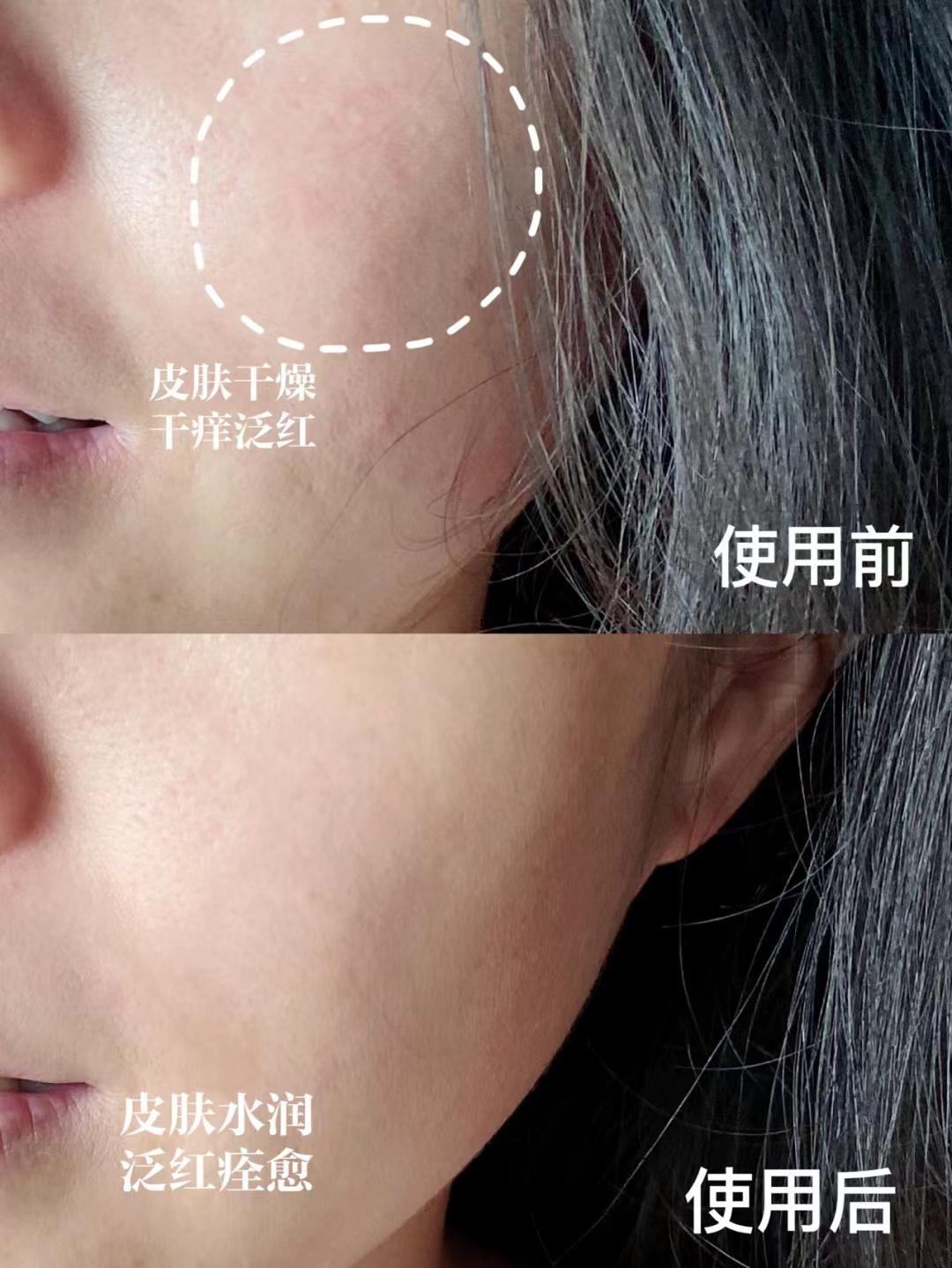 哪款精华液抗皱最好用,50岁左右女性适合什么精华液