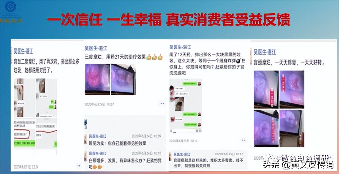 唐淑玉丹：消毒产品自称可以“缩阴”，四级代理模式包含何种奖励