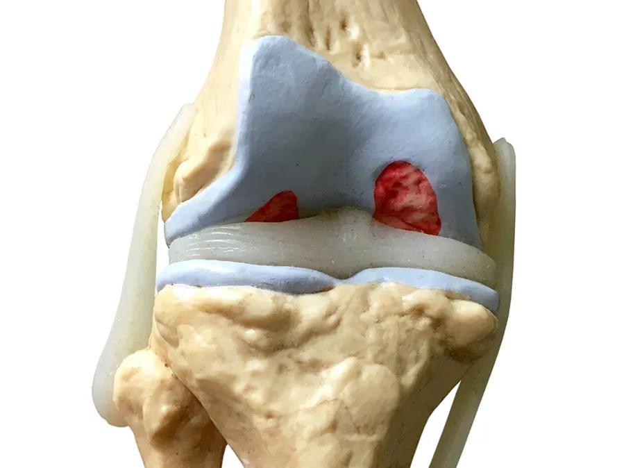 氨糖到底有没有效果,氨糖到底是噱头还是真的有用