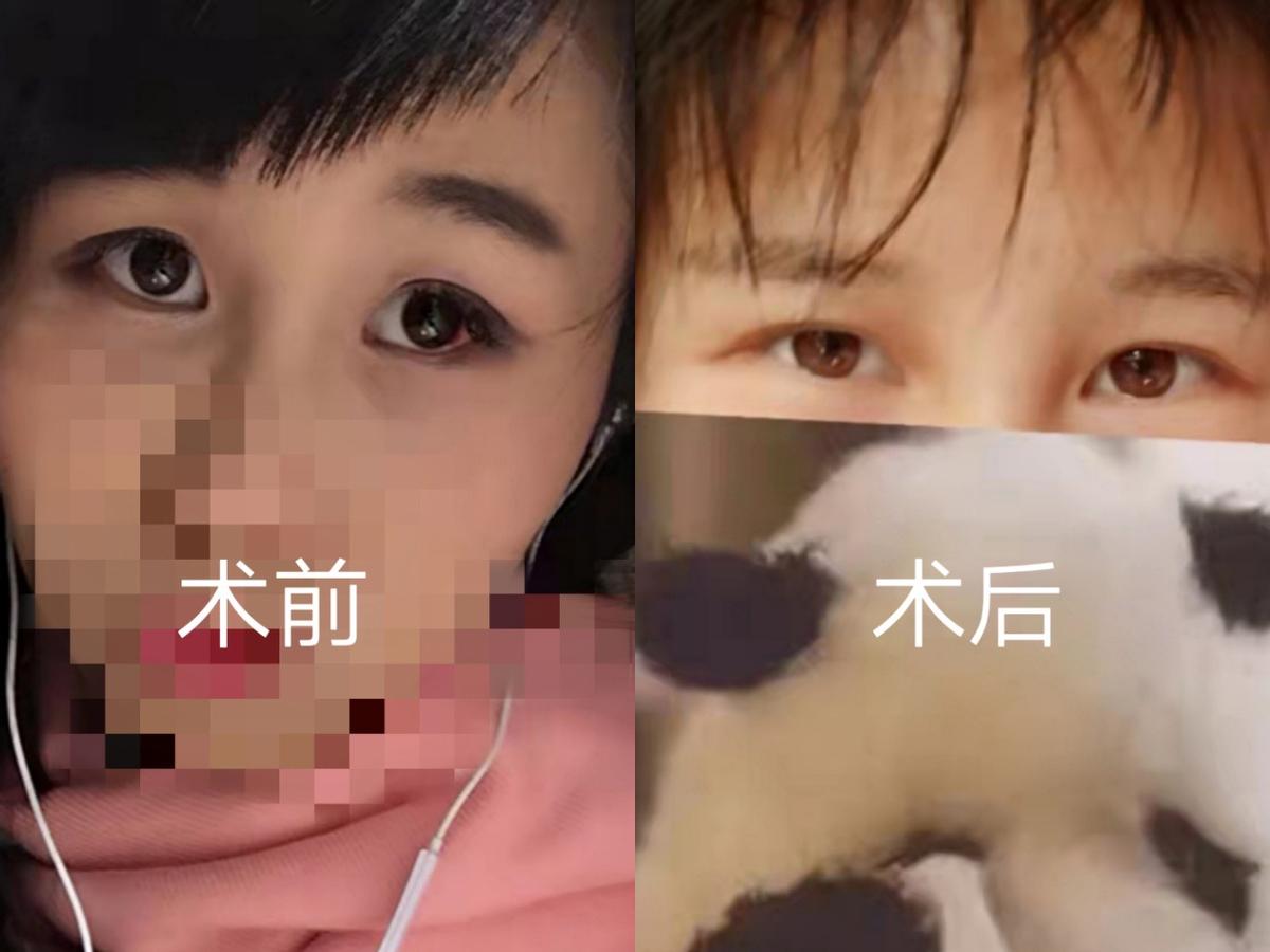 麻药失效了但是手术还在继续,麻药失效做手术