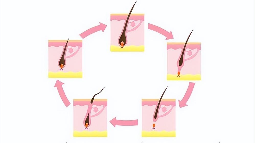 26岁脱发特别厉害秃了怎么办,26岁小伙脱发的烦恼