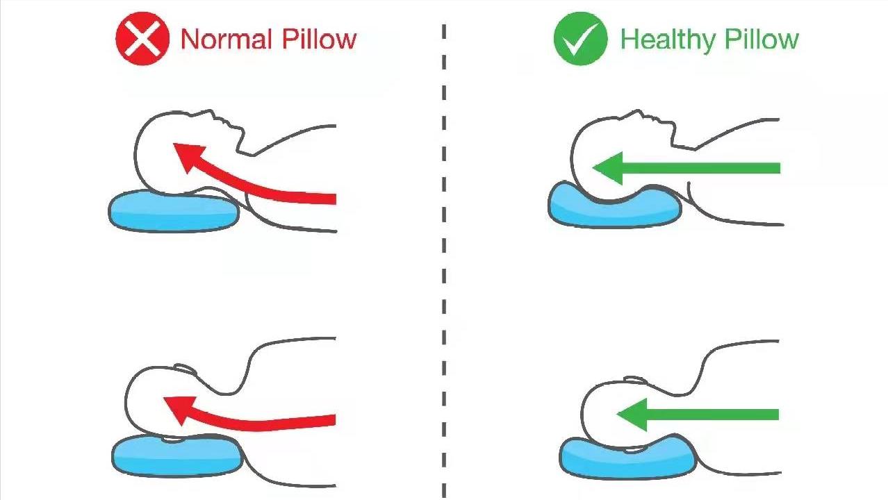 脖子疼就是颈椎病,脖子疼颈椎病怎么缓解