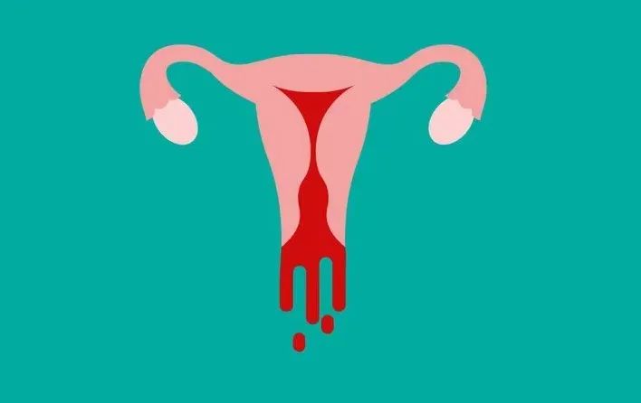 来大姨妈时里面有“肉块”，是不是生病了？