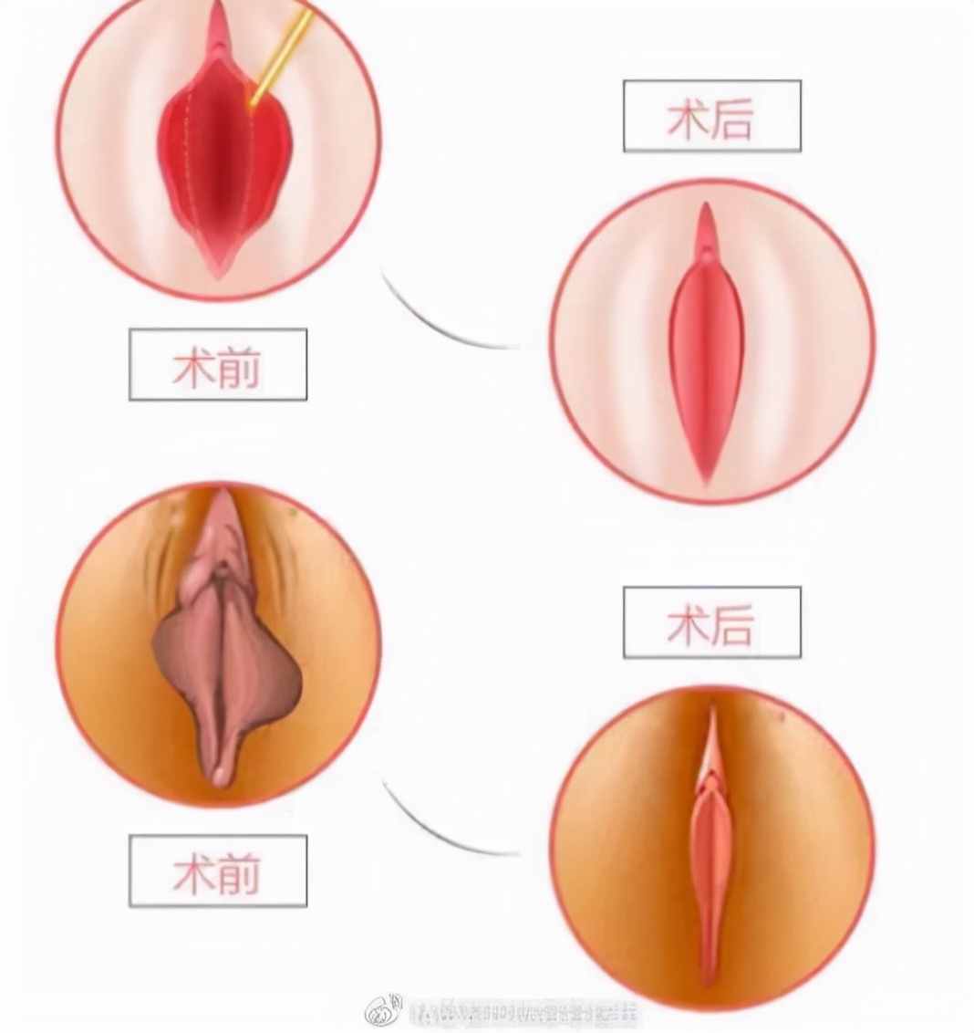 有没有必要做私密整形,你有没有必要整容