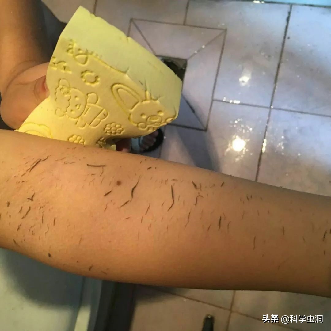 洗澡搓下来的黑泥到底是什么？显微镜放大100倍，画面不忍直视