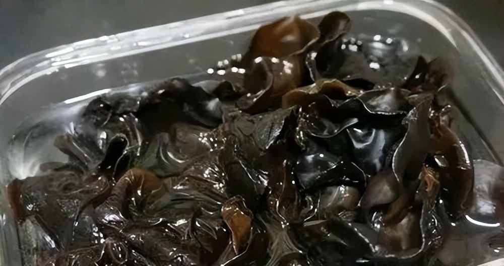 这根血管连通大脑最容易堵!很多人半身不遂后才发现!不看后悔!