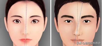 塌鼻子隆鼻一年后的真实感受,三甲医院整鼻子靠谱吗