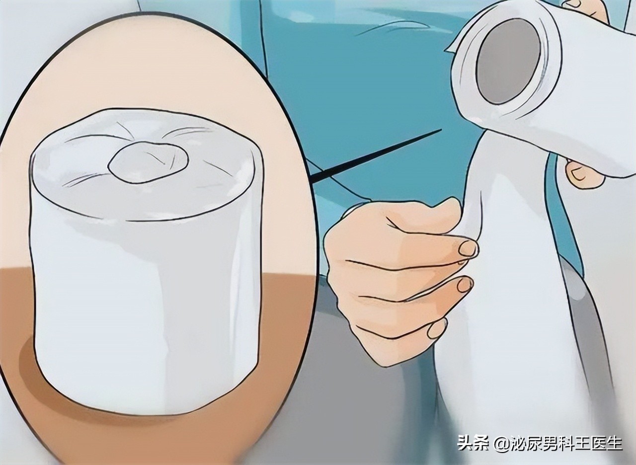 “难以启齿”的肛管癌，你了解它吗？出现3个症状，及时就医检查