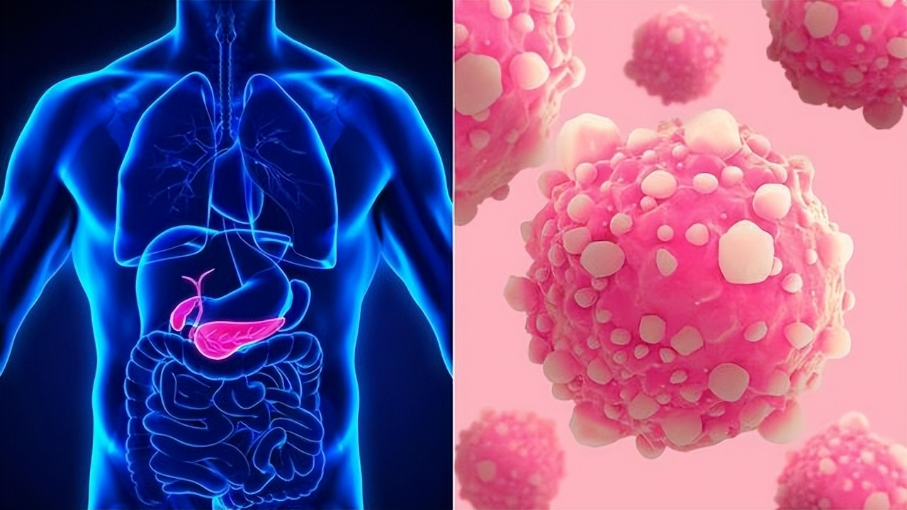 从炎症到癌症三种炎症别拖着,从炎症到癌症一般需要多久