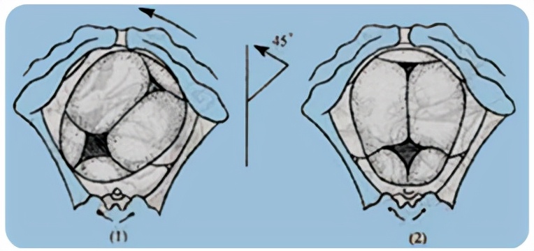 孕妈妈怎么判断胎位是正的,胎儿屁股在右侧是什么胎位