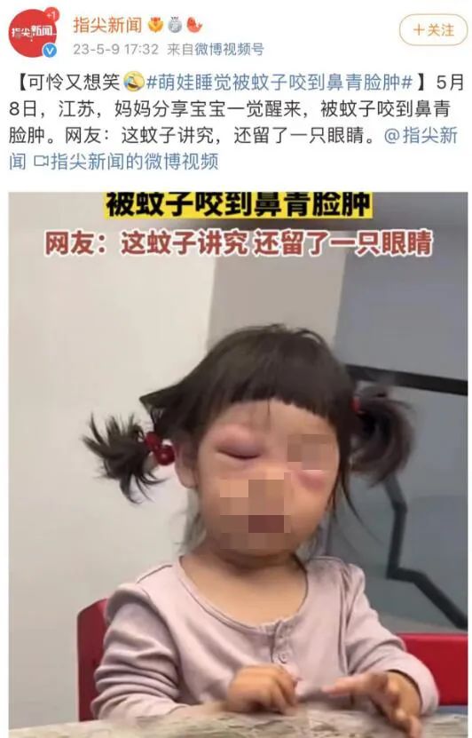 宝宝脸上被蚊虫叮咬几天还红肿,宝宝脸部被蚊虫叮咬出水泡化脓