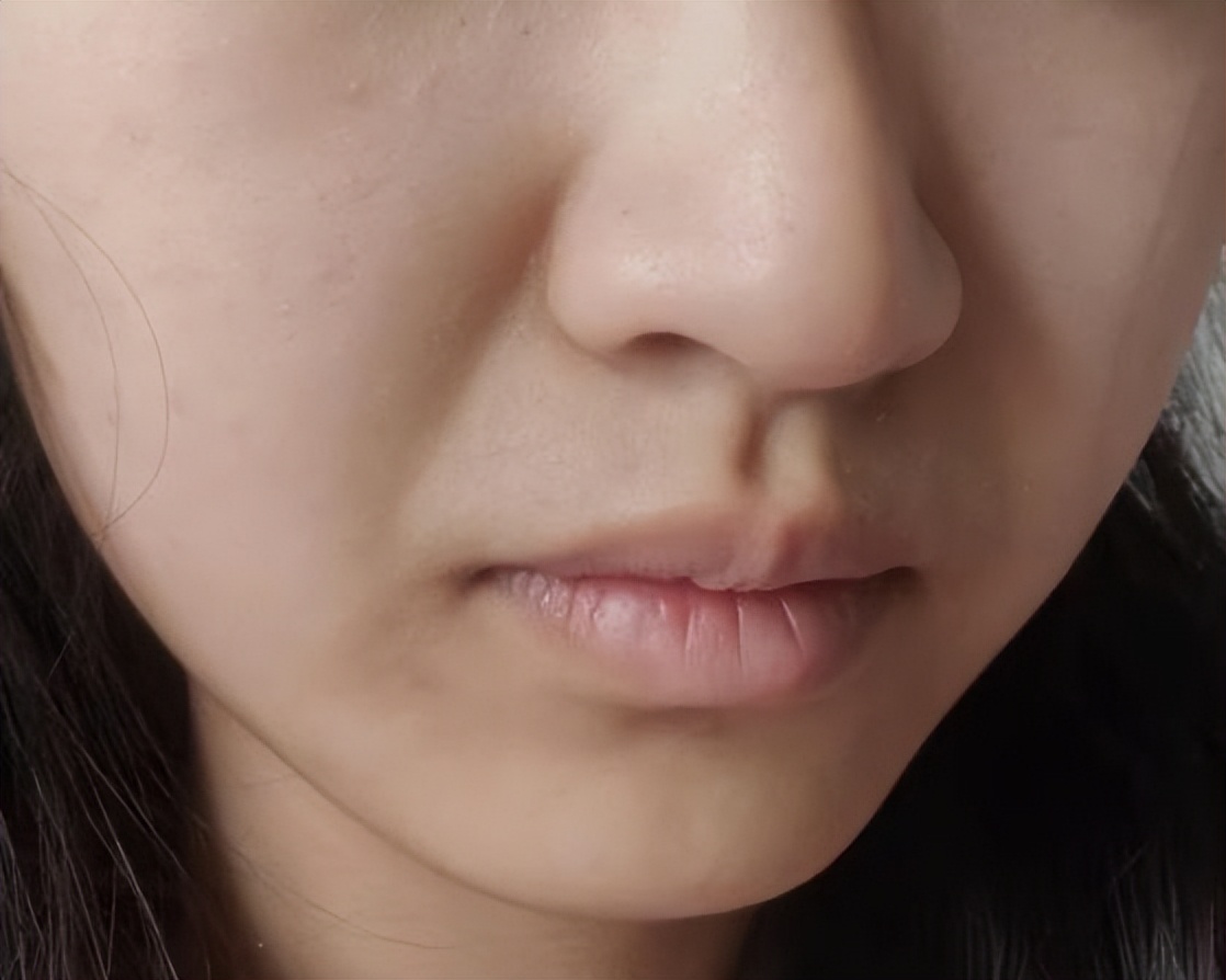 美白抗衰精华大盘点,美白抗衰精华能用吗有害没