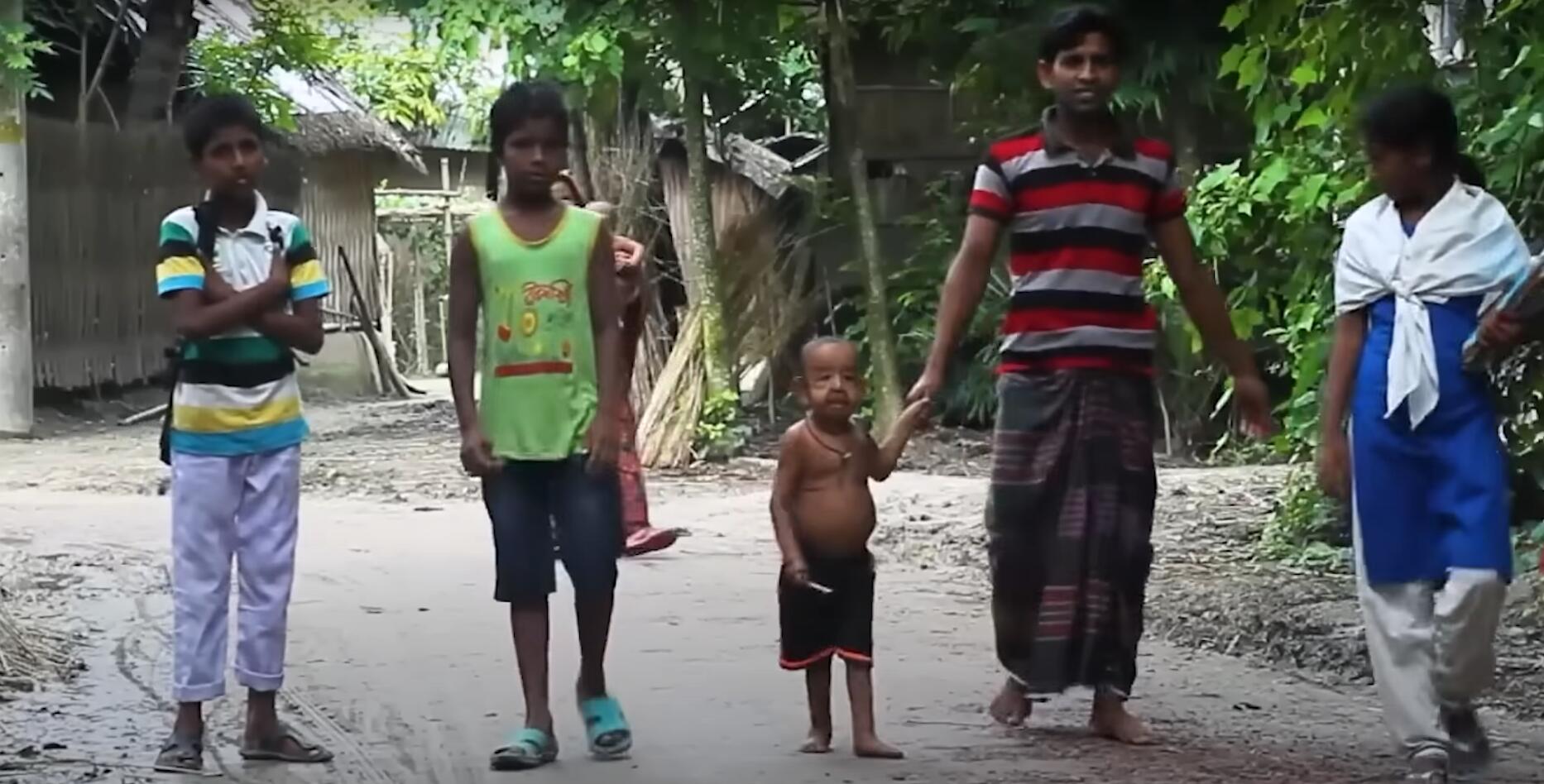 10个难以置信的人类，树皮人、外星人、拥有粗壮手臂的大力水手