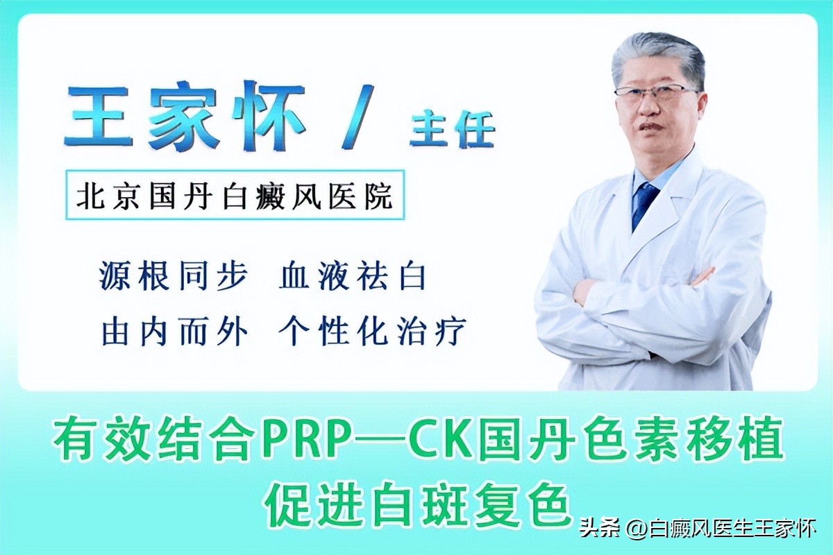 肢端型白癜风最佳治疗时间表,白癜风皮损护理方法