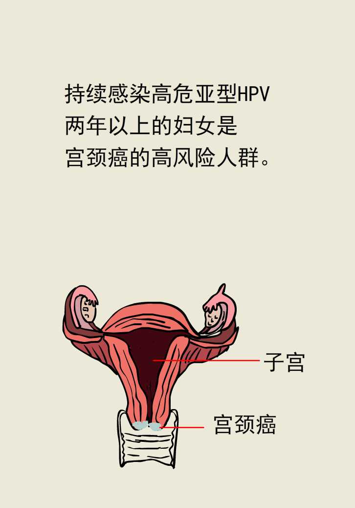 女性白带像水一样臭,女性白带呈稀薄发粘怎么回事