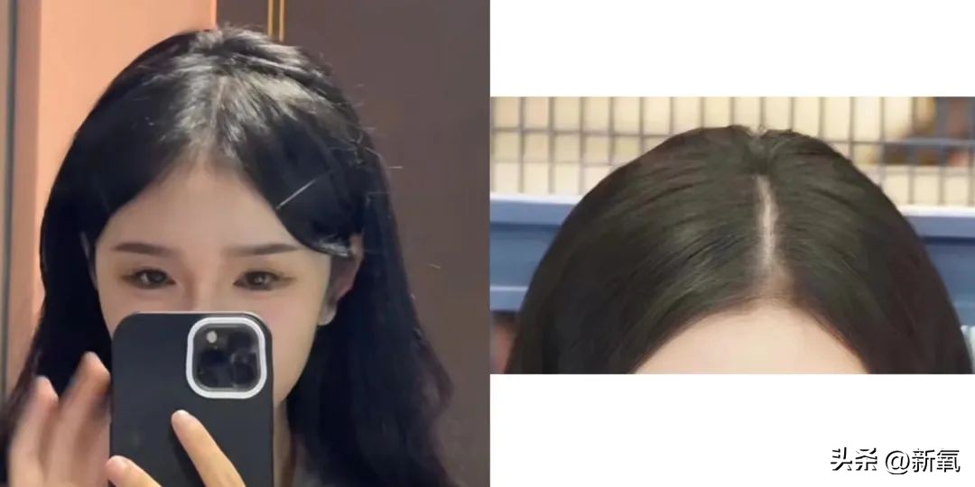 孔雪儿的颅顶美上热搜，“后脑勺垫发”真的那么神奇吗？