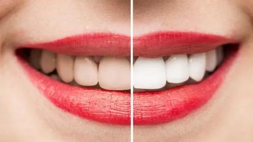 牙齿变黄了用什么方法清洗最干净,怎么样去牙齿发黄小妙招