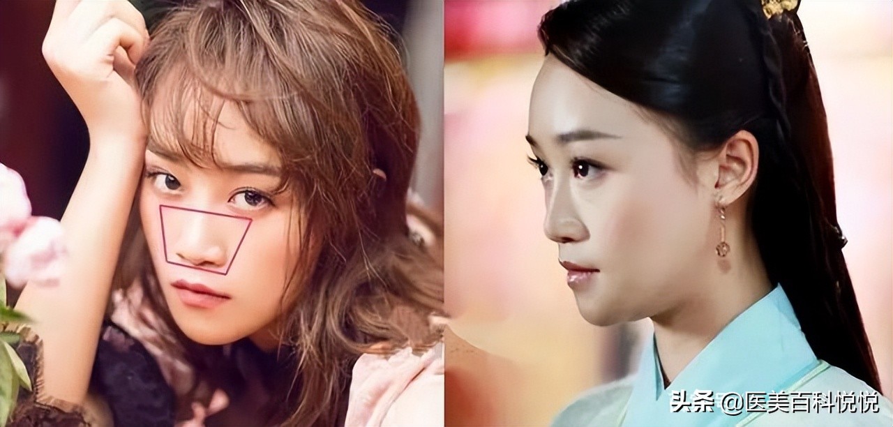 苏王——你是苦相脸吗，苦相脸的人该怎么调整呢？