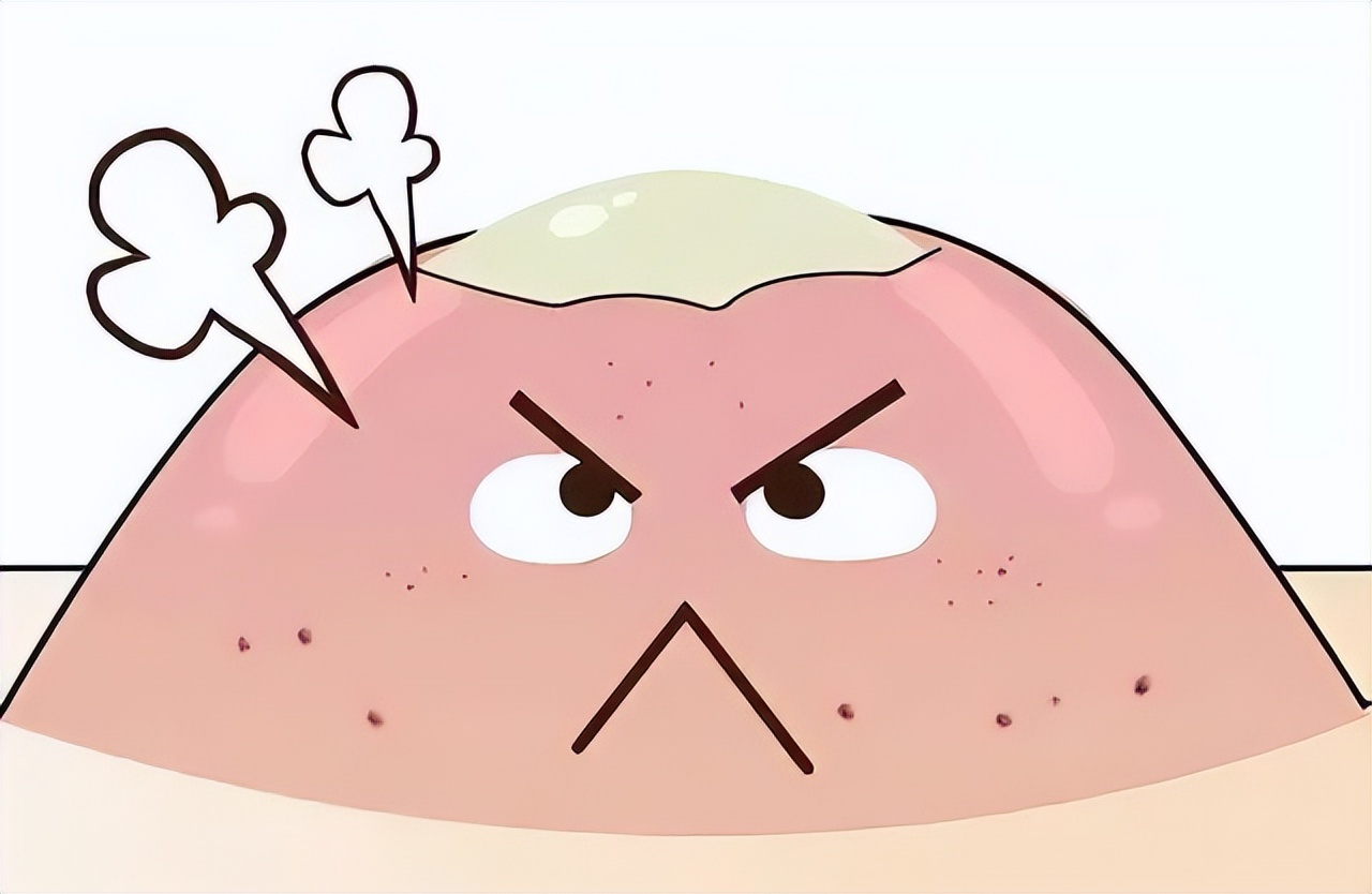 抗痘推荐22岁,青年人痘痘怎么治