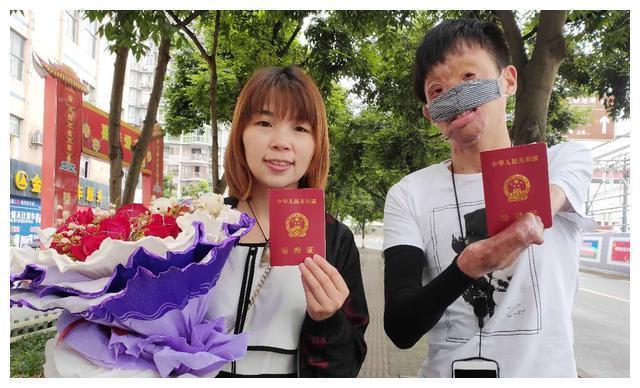 新郎救火时毁容新娘依然嫁给了他,新郎被烧伤新娘前往医院