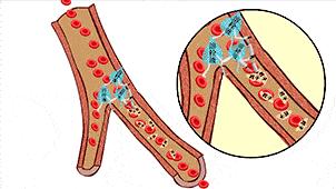 急性心梗的病人发生心脏骤停,急性心梗溶栓快还是支架快