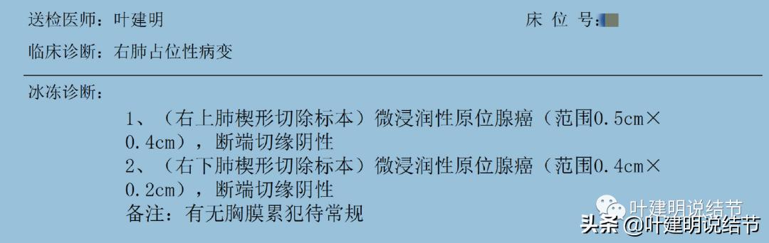2cm的肺磨玻璃结节如何处理最合适,年轻女人磨玻璃结节