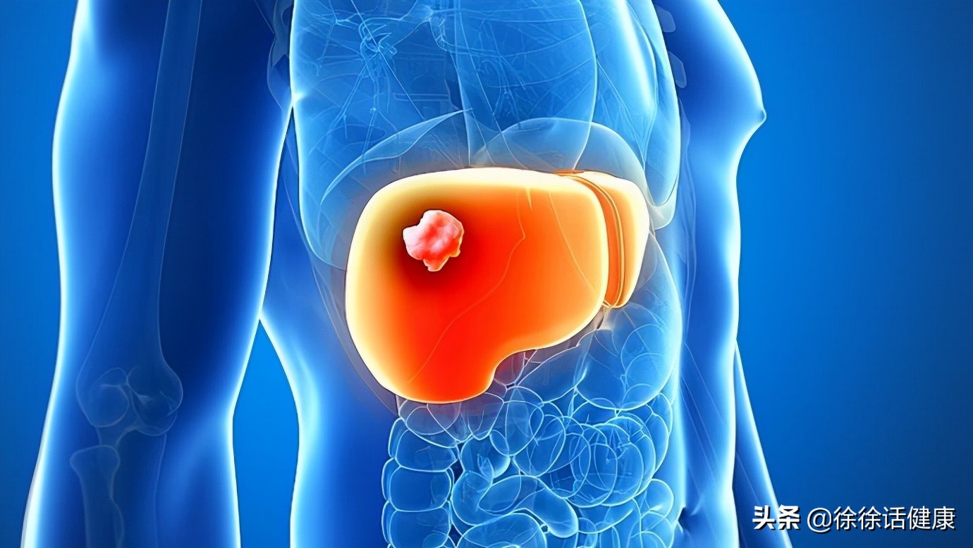 肿瘤标志物正常代表没有癌吗,肿瘤标志物都代表啥