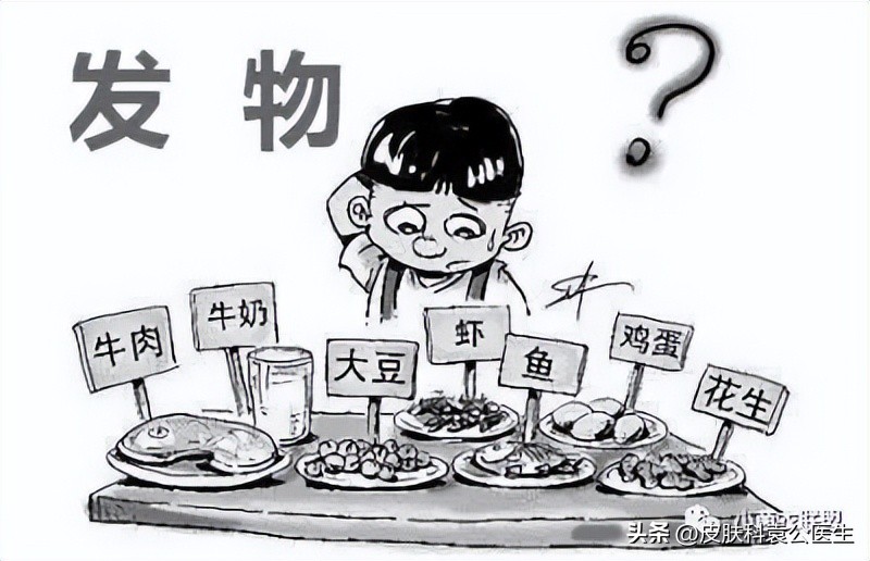肾病发物忌口的食物一览表,得了皮肤病是否要忌口