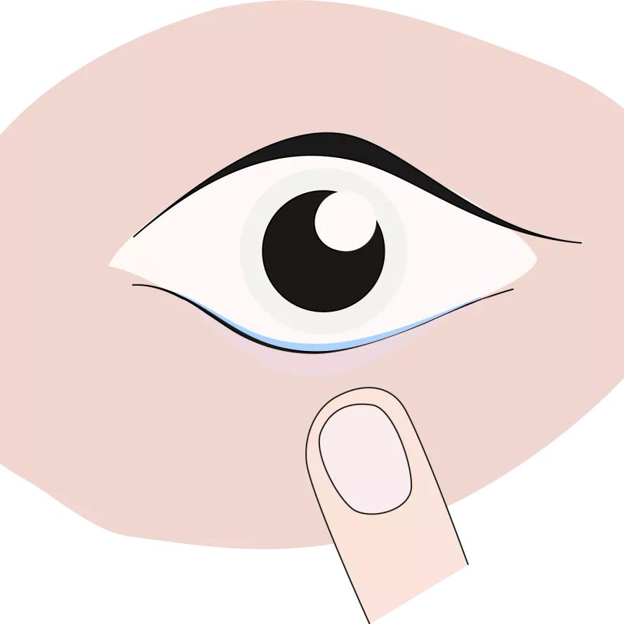 阿托品缓解眼睛疲劳吗,含有阿托品眼药水推荐