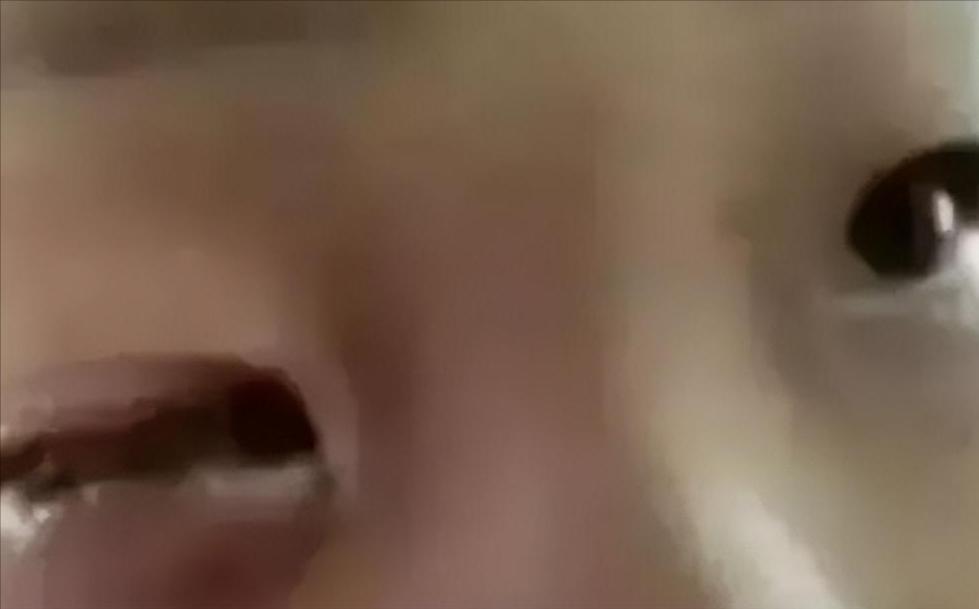 7岁男孩眼球被炸后融化,七岁男童眼睛秒被溶化