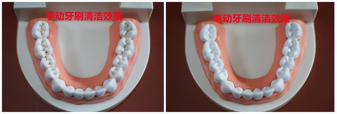 儿童电动牙刷利弊,什么样的儿童电动牙刷比较好