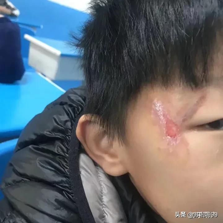 自闭症孩子父母过世孩子何去何从,有自闭症孩子家庭何去何从