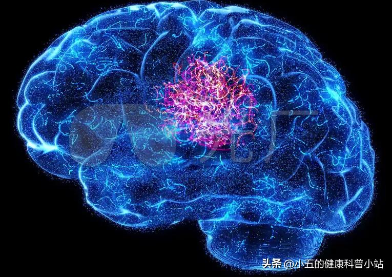 唑吡坦治失眠一般用量,唑吡坦适合严重睡眠障碍病人吃吗