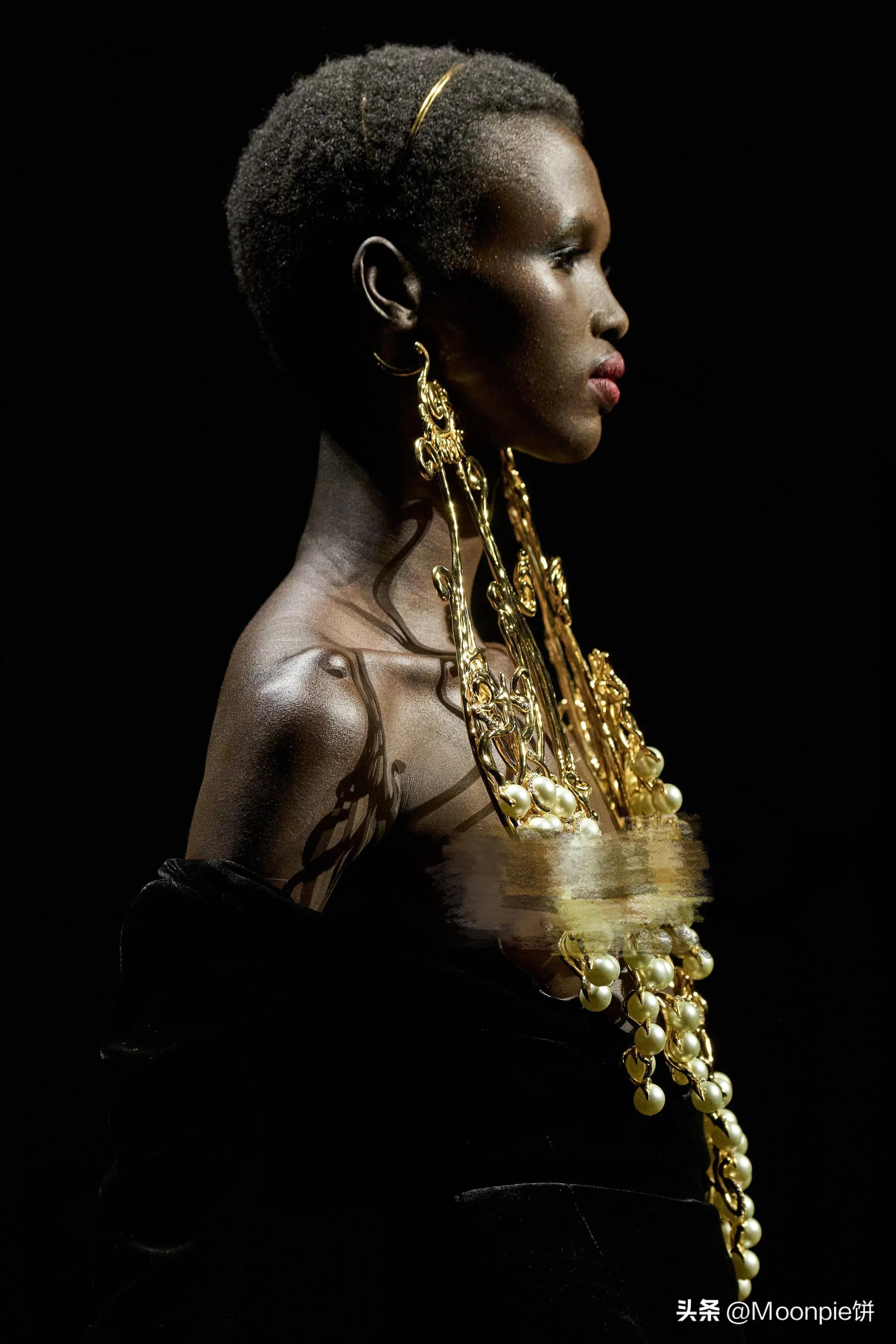 为什么胼胝体会缺失,schiaparelli水平