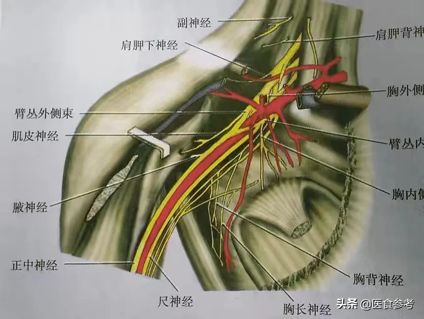 新生儿孩子臂丛神经被拔断,新生儿臂丛神经被拉断还能接上吗