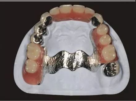 广州哪家医院看牙比较实惠,广州三甲医院种牙齿多少钱一颗