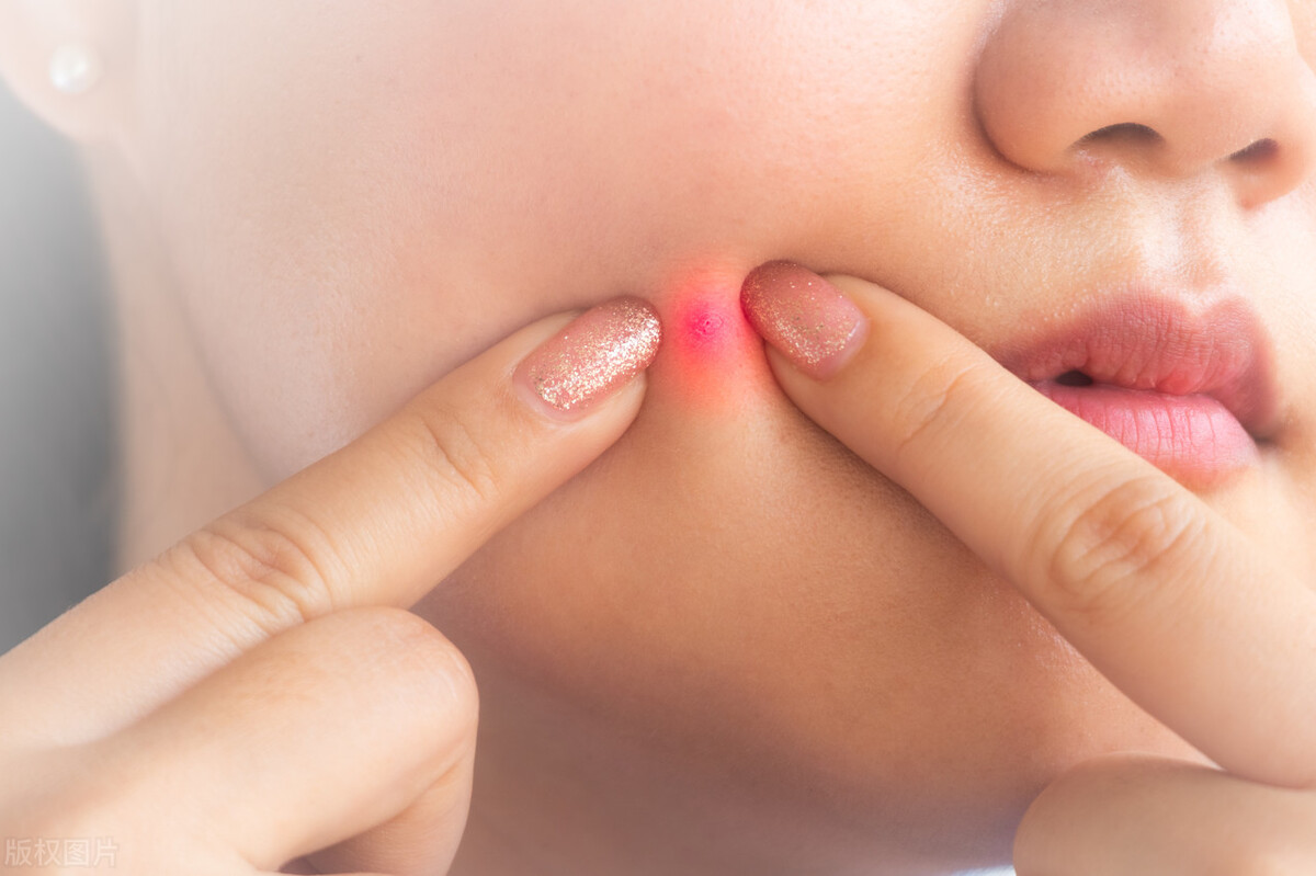 阳康之后，痘痘一个劲往外冒，好想挤掉，怎么办