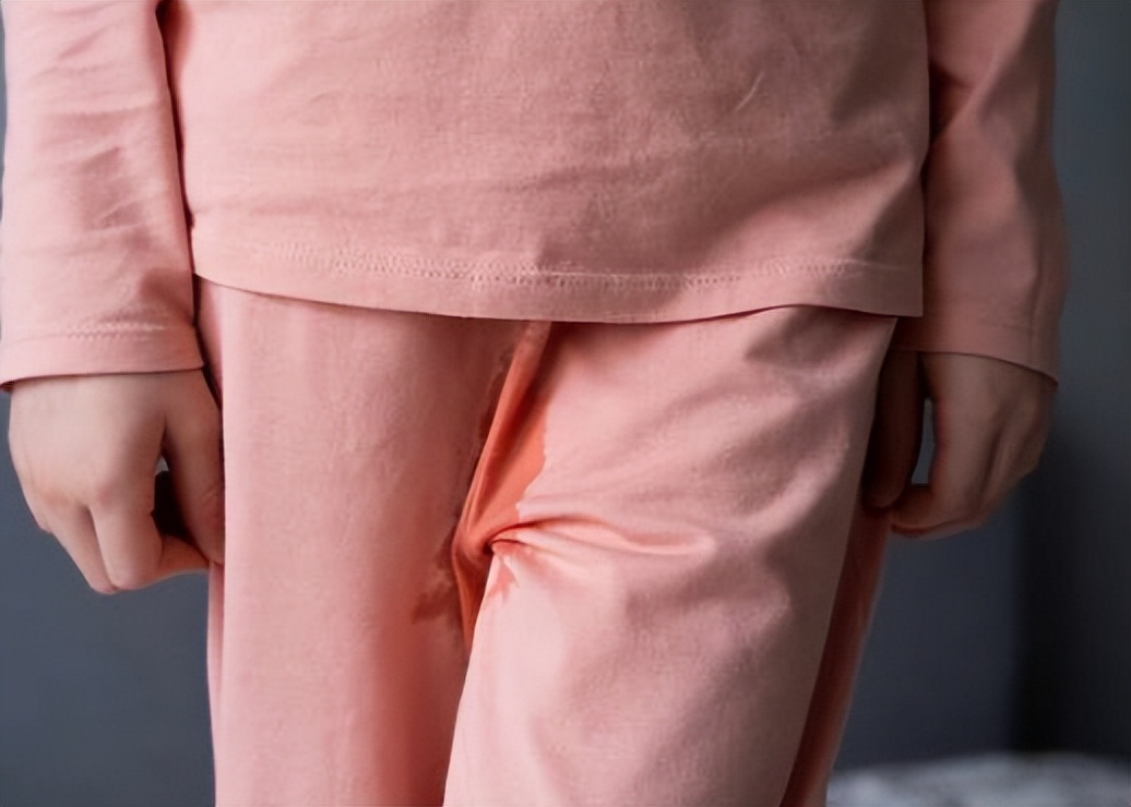 阴挺症状有哪些,阴挺是什么病用什么药