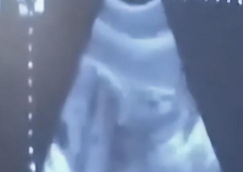 91岁老太怀孕离奇真相,老太意外怀孕60多年