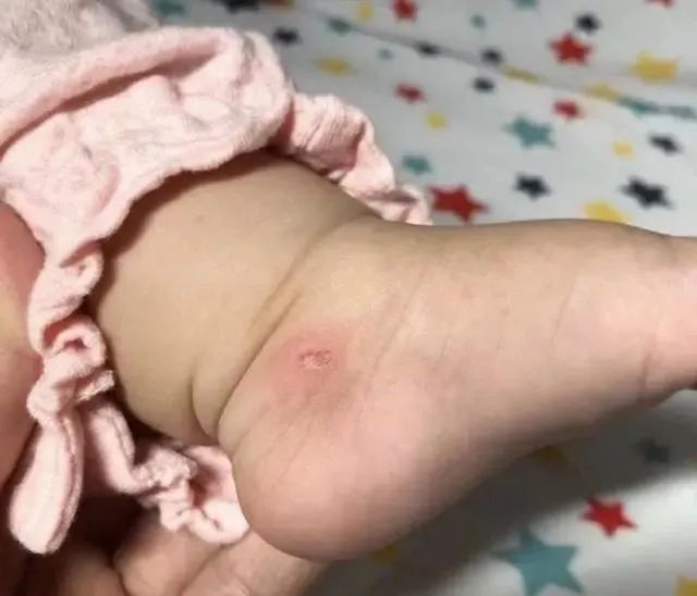 小女孩疑遭父母当街残忍虐待后续,一岁女婴被虐待