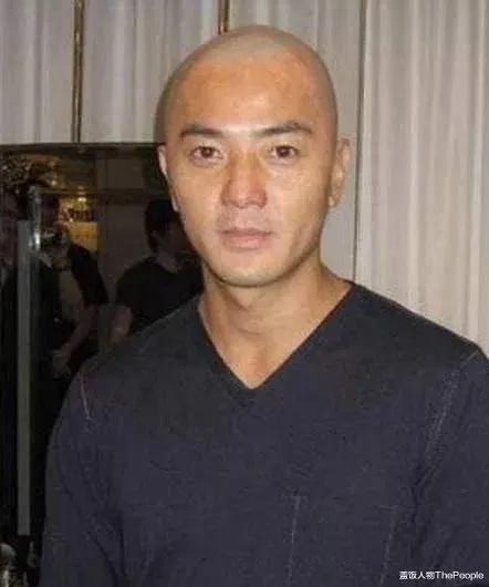 男明星光头对比,男星秃头前后对比