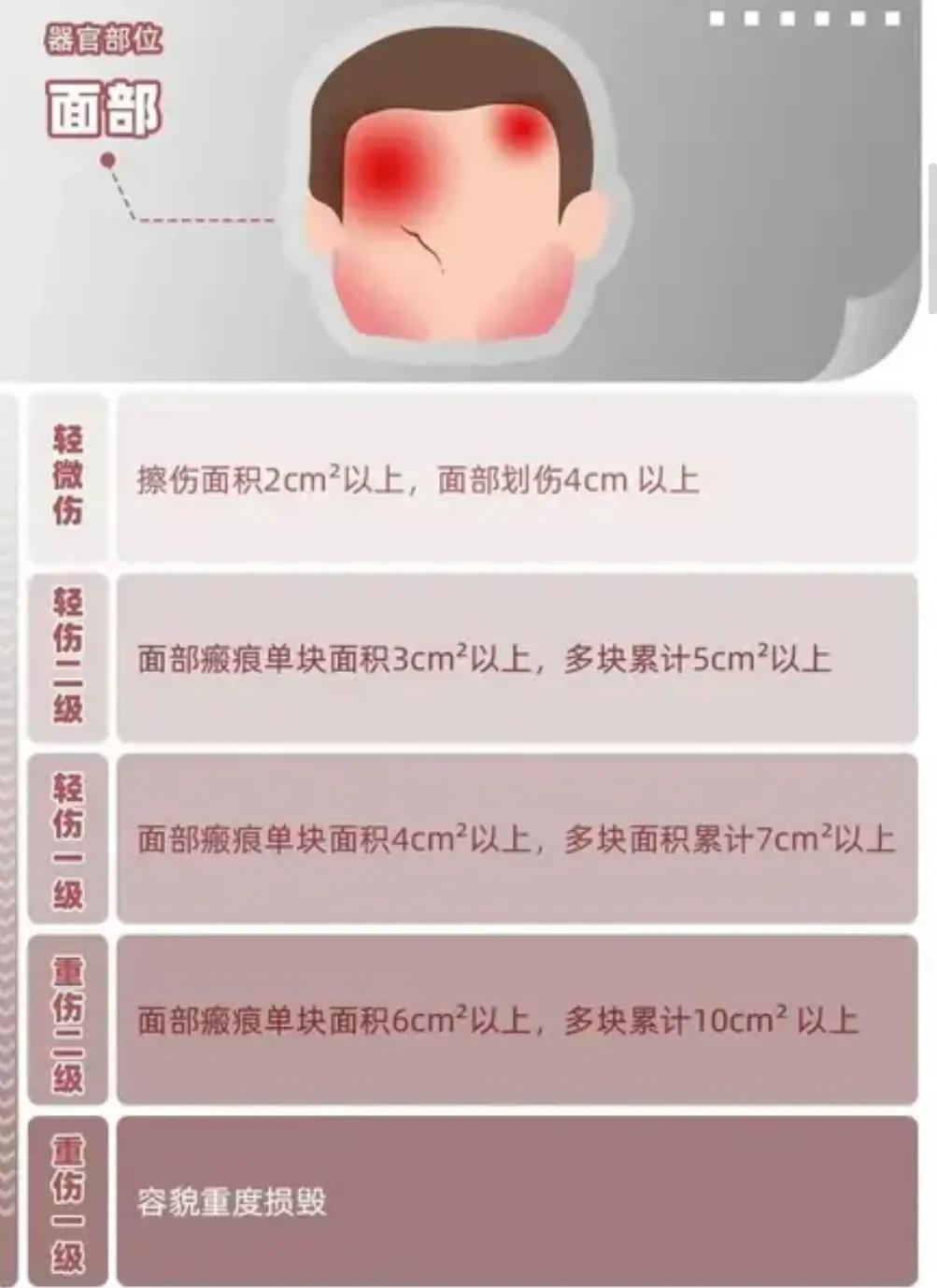 唐山打人轻伤二级鉴定标准,唐山事件轻伤二级