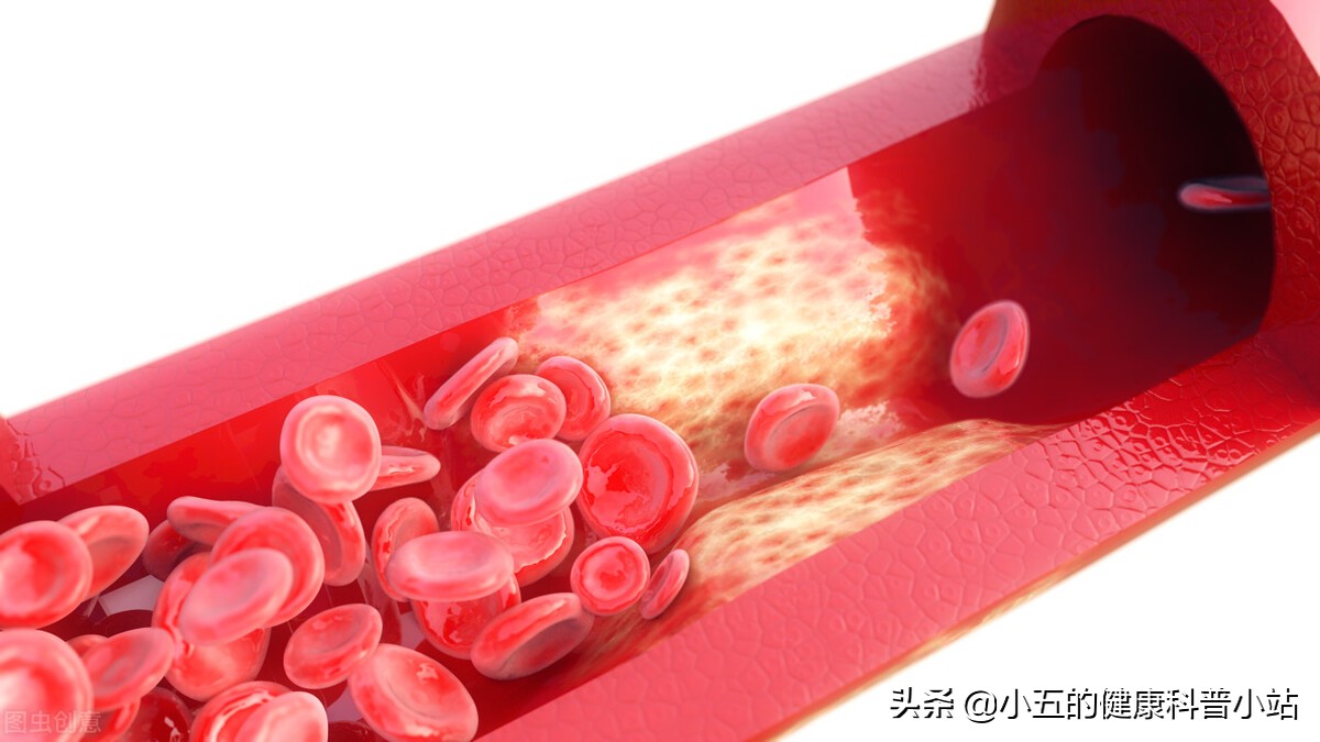 活血化瘀冠心病,冠心病人能吃心脑宁胶囊吗