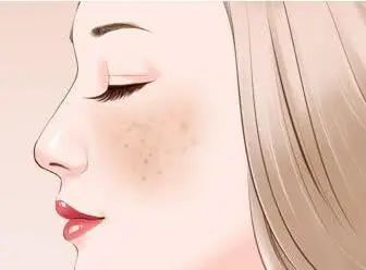 肤色暗沉怎么提亮,肤色暗沉怎么改善